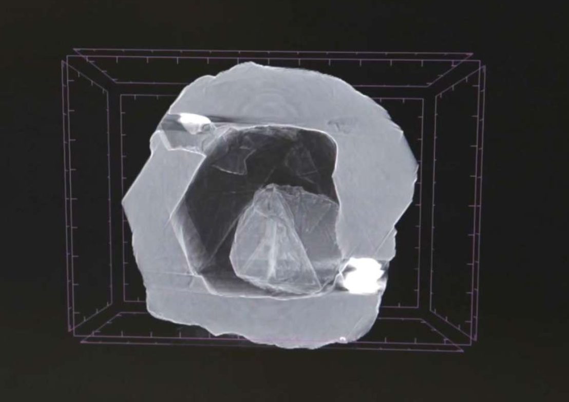 Diamond Xray